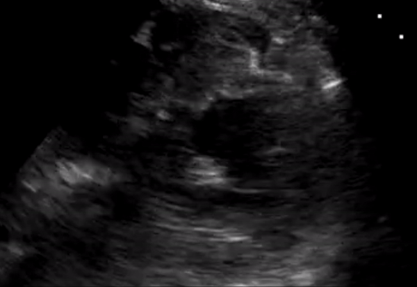 EEU case image missing